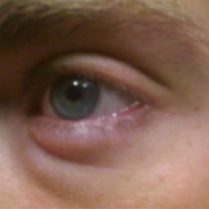 Does anyone know wtf is going on with my eye???? Its freakin me out. Im hea