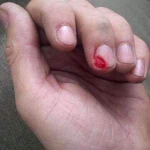 Grinder slip... fail. :o