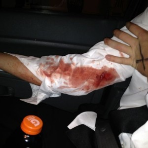 Roommate fell hard flat on his face while giving a girl a piggy back ride, 