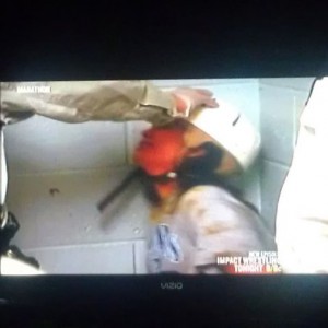 Girl had to wear a helmet for beating her head of a wall Lulz