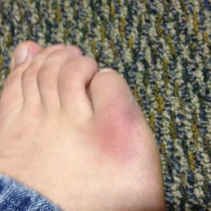 I think I broke my toe last night, i wish I could remember what I did last 
