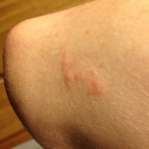 All I have to do is look at poison oak and I get the stuff.... Had to get a