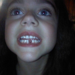 Dental floss and it's gone!