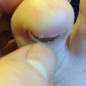 Barely on.... Looks terrible. Peel it off? Or let it run it's course?