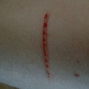 My cat got angry...