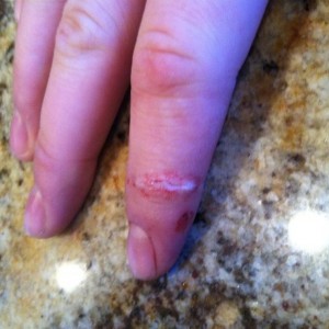 Cut my finger with my knife yesterday. Just finally stopped bleeding this m