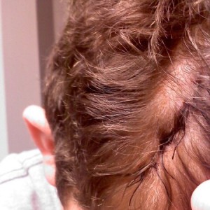 It did this when I hit my head on the cage. 6 stitches and a light concussi