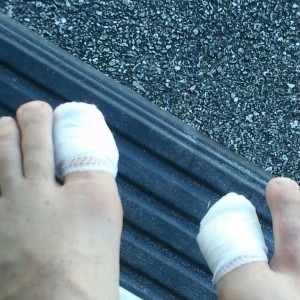 I haz matching toes. Blood blisters suck. Lol