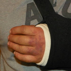 wrist_007