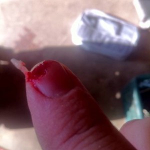 Fingers and table saws dont mix well!!!!