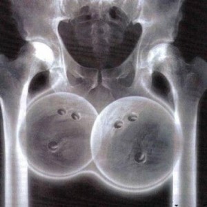big_balls1