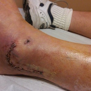 IMG00317-20111025-1346