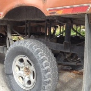 body lift