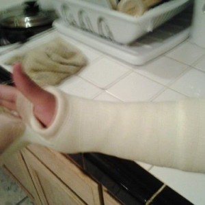 my new cast, went to my 2 week appointment, have another 2wks for my next o