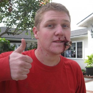Dirt bike accident