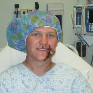 Dirt bike accident