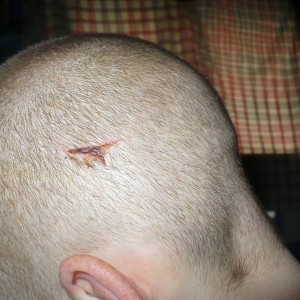 Healing Well