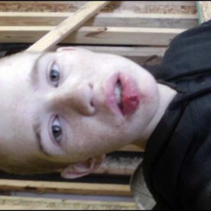 Hammer to the face, tooth through lip