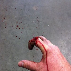Oops "we got a bleeder"