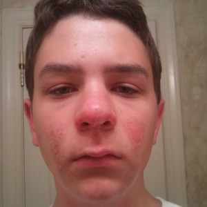 Day after