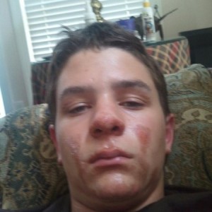 5 days after