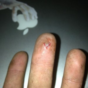Just stabbed the crap out of my finger. I need a tetanus shot now.