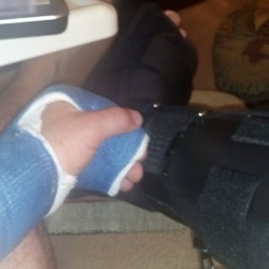 Left hand right leg both busted. Sent from my mobile device