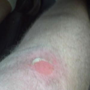 That's why my knee hurt