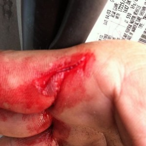 Metal cuts suck!