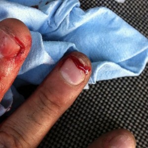 Today is bringing the SUCK!!! Just drove my fingernail through the tip of m