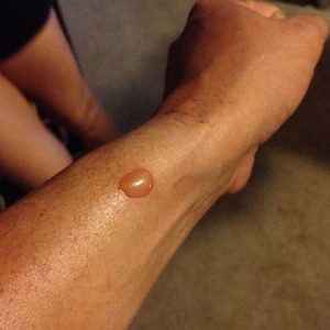 Perks of camping. I think its a bug bite. Doesnt hurt, not feeling weird or