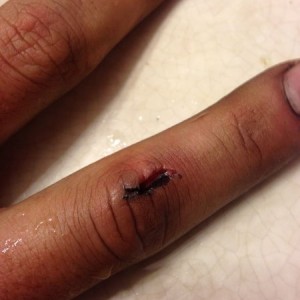 Grinder to the finger hurts.