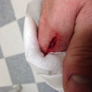 Ouch!