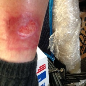 My boots are creating a hole in my leg