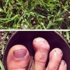 I'd get that fixed if that was my toe!