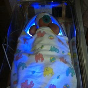 Thoughts and prayers for my boy. If the light treatment doesn't help h