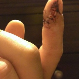 Wiring injury
