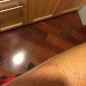 Got stung by a bee a couple minutes ago on my arm. That hurt!