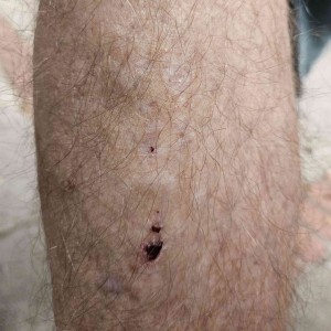 Leg