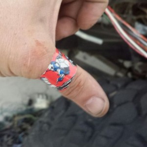 Boba Fett band-aid applied by Jasmine who says Ohh you get a storm trooper 