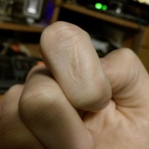 Sliced my finger to bone about a decade ago. Only put bandaid on it. Seems 