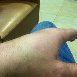 OUCH. Note to self move hand out of way when swinging hammer.Thanks GM stup