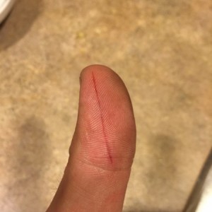 Thank you Mr. Razor Knife, I needed that today... Sucker finally stopped bleeding.